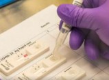 El CCFC adverteix del risc que suposa per a la salut la proliferació de tests d'antígens sense garanties